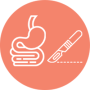 Gastrocirurgia